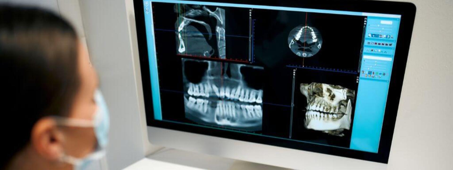 Dental X-Rays: The 4 Different Types and Their Use Dental X-Rays: The 4 Different Types and Their Use