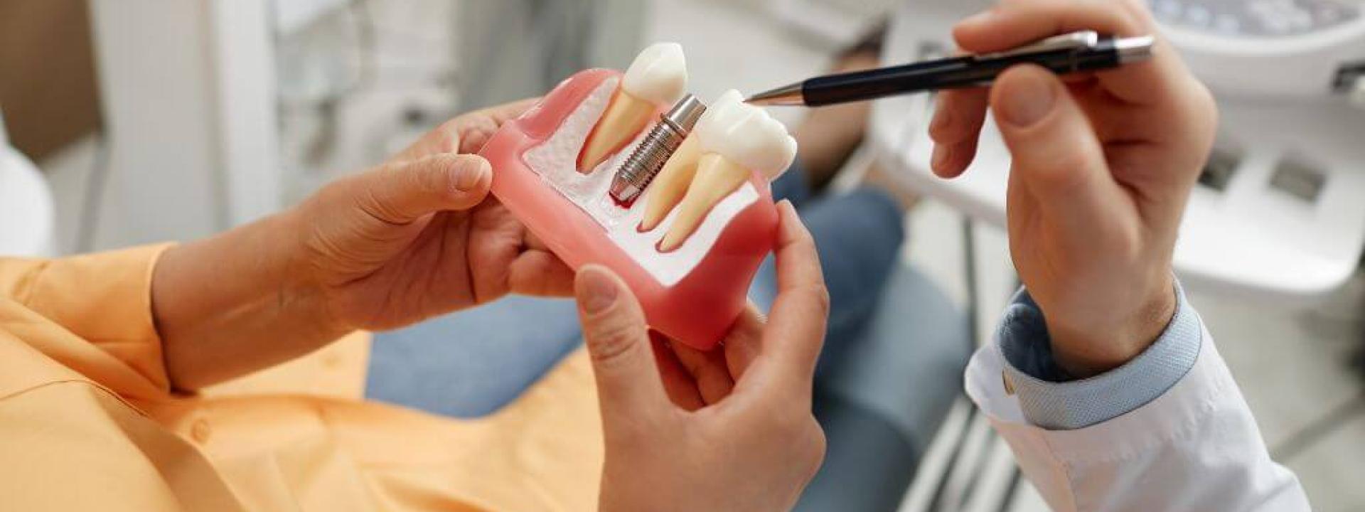 Dentures vs. Implants: Exploring Options for Full Arch Restoration Dentures vs. Implants: Exploring Options for Full Arch Restoration