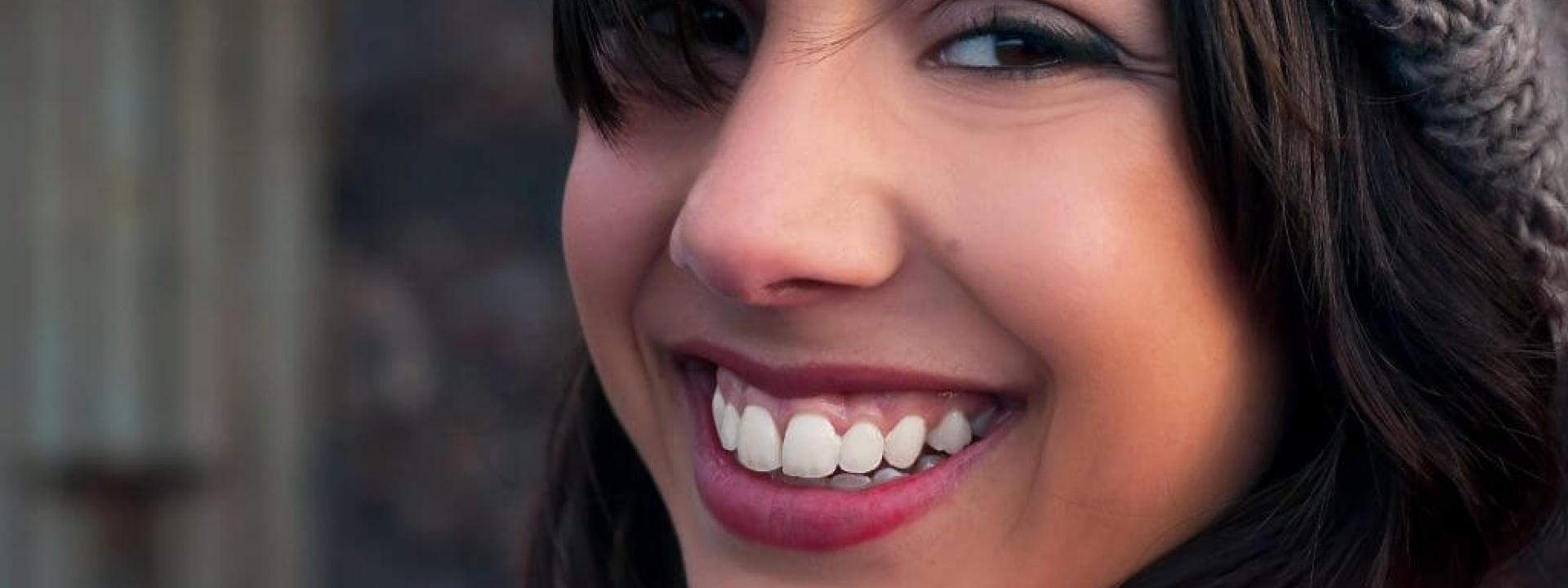 Gummy Smile Treatment Gummy Smile Treatment